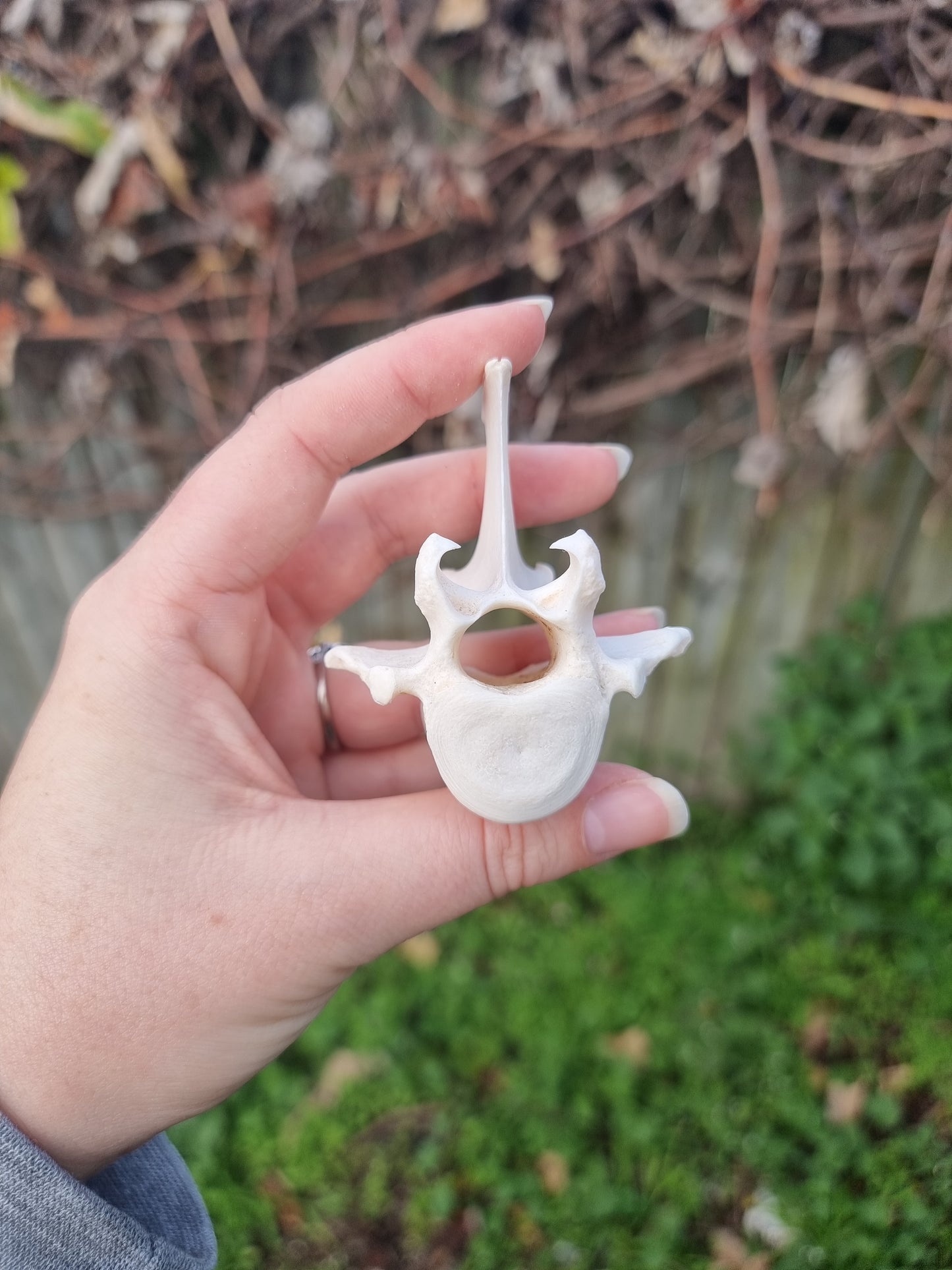 Vertebrae